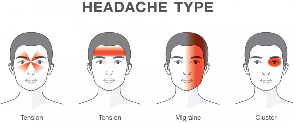 Headache-or-Migraine